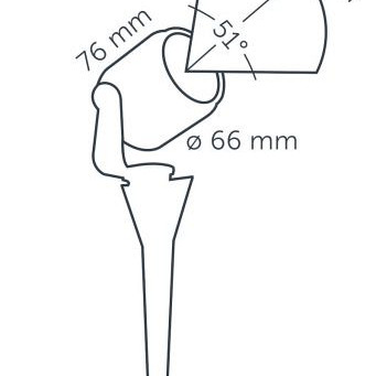 in-lite - Big Scope
